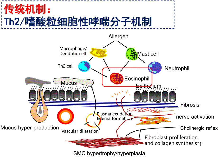 医学交流课件：嗜酸细胞在哮喘发病中的作用机制_第3页