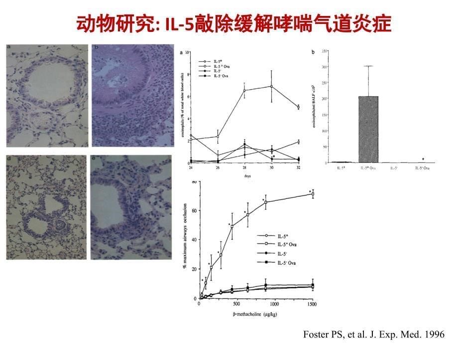 医学交流课件：嗜酸细胞在哮喘发病中的作用机制_第5页