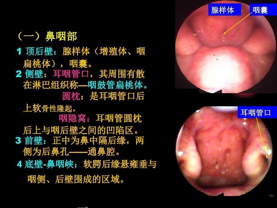 咽喉气管食管解剖_第5页