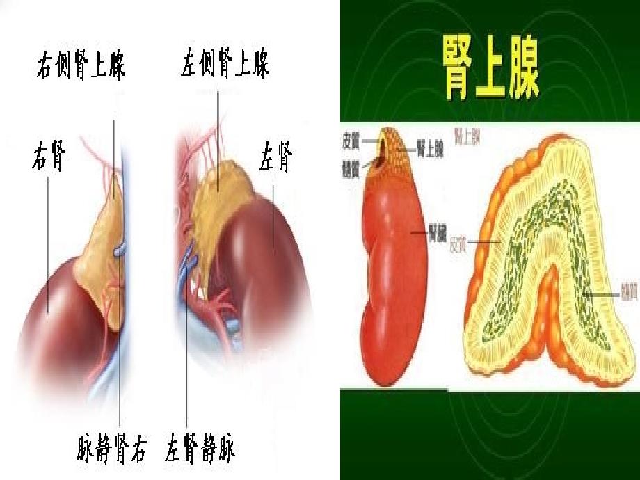 后腹腔镜肾上腺肿瘤切除术ppt课件_第3页