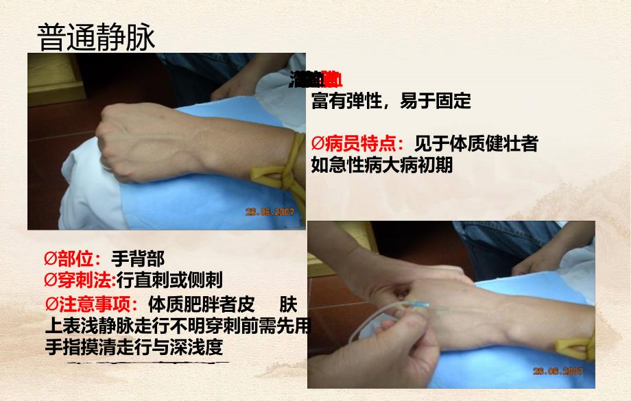 静脉穿刺技术课件文档资料_第4页