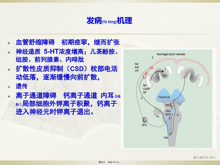 偏头痛诊治-博士课件_第5页