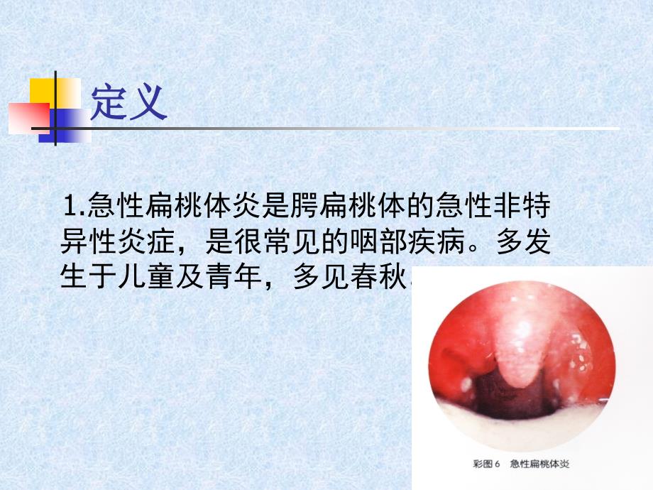 急性扁桃腺炎PPT课件_第2页