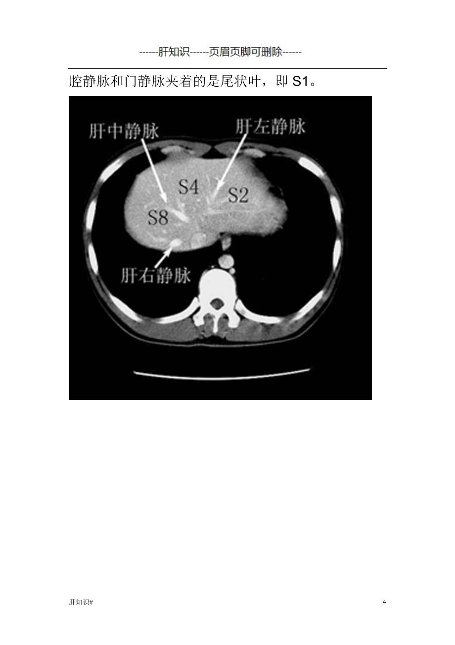 肝脏CT分段(图文)#肝相关类_第4页