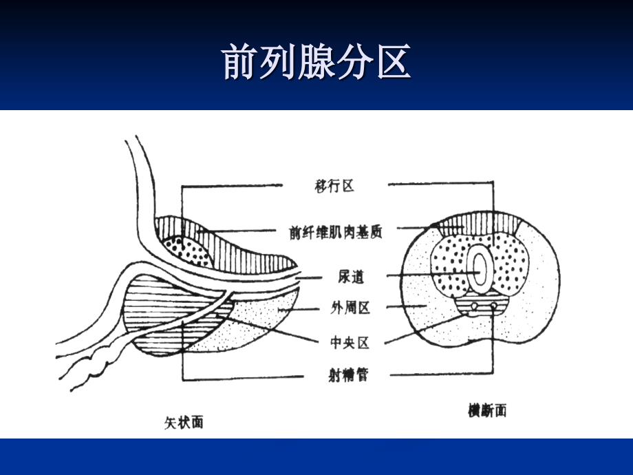 前列腺癌的诊断与治疗ppt课件_第4页