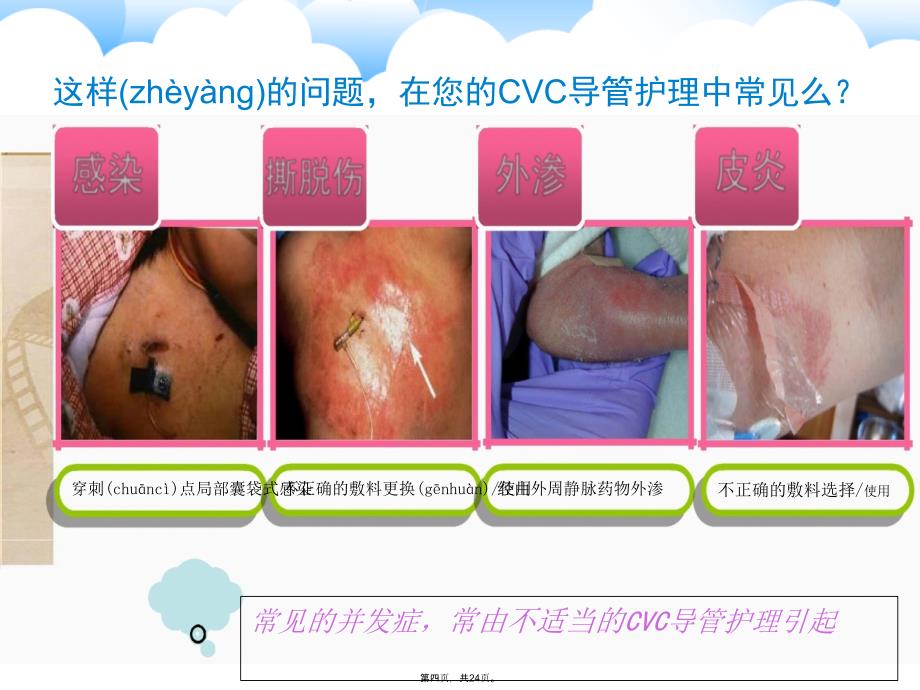 中心静脉导管相关血流感染预防策略教学资料_第4页