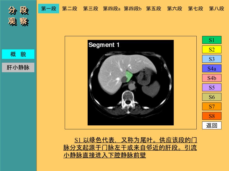 肝脏CT解剖图记忆_第4页