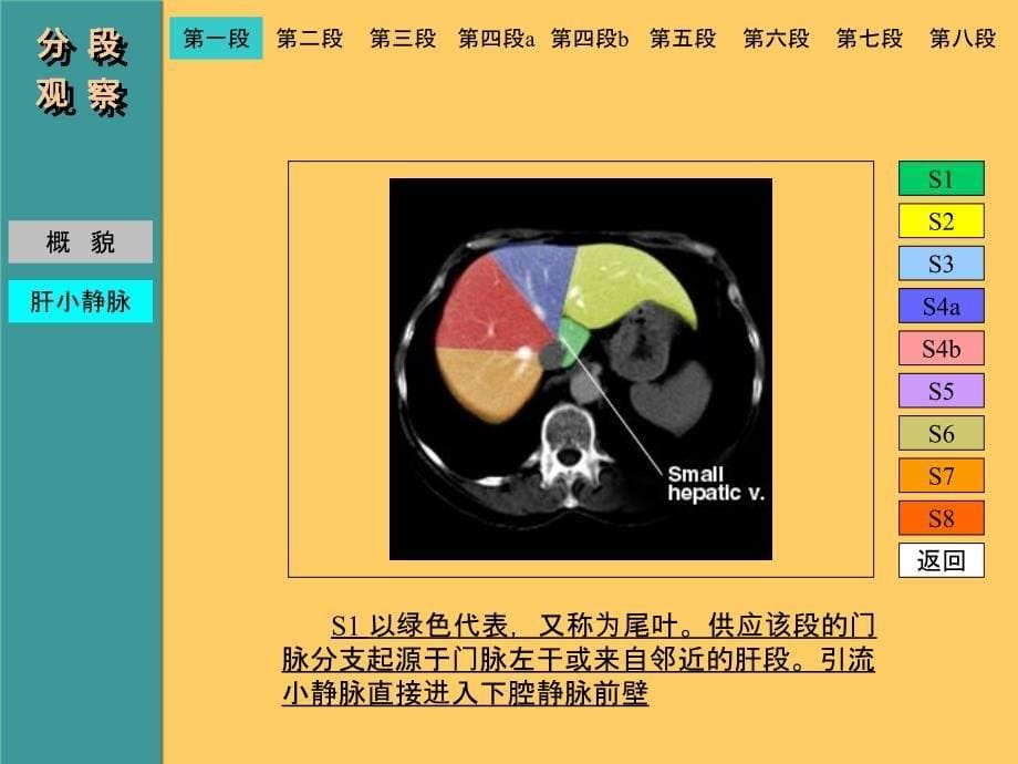 肝脏CT解剖图记忆_第5页