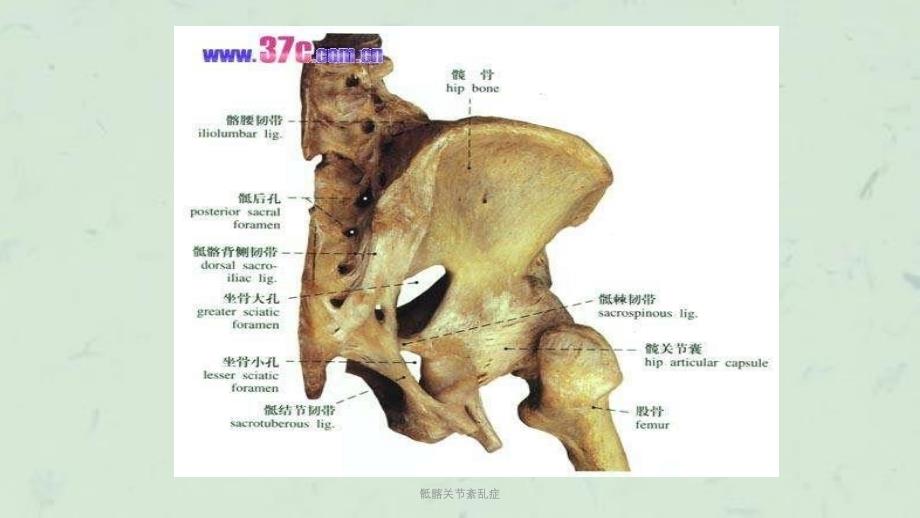 骶髂关节紊乱症课件_第3页