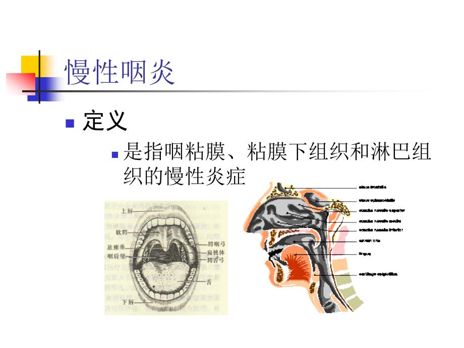 耳鼻咽喉科PPT课件_第2页