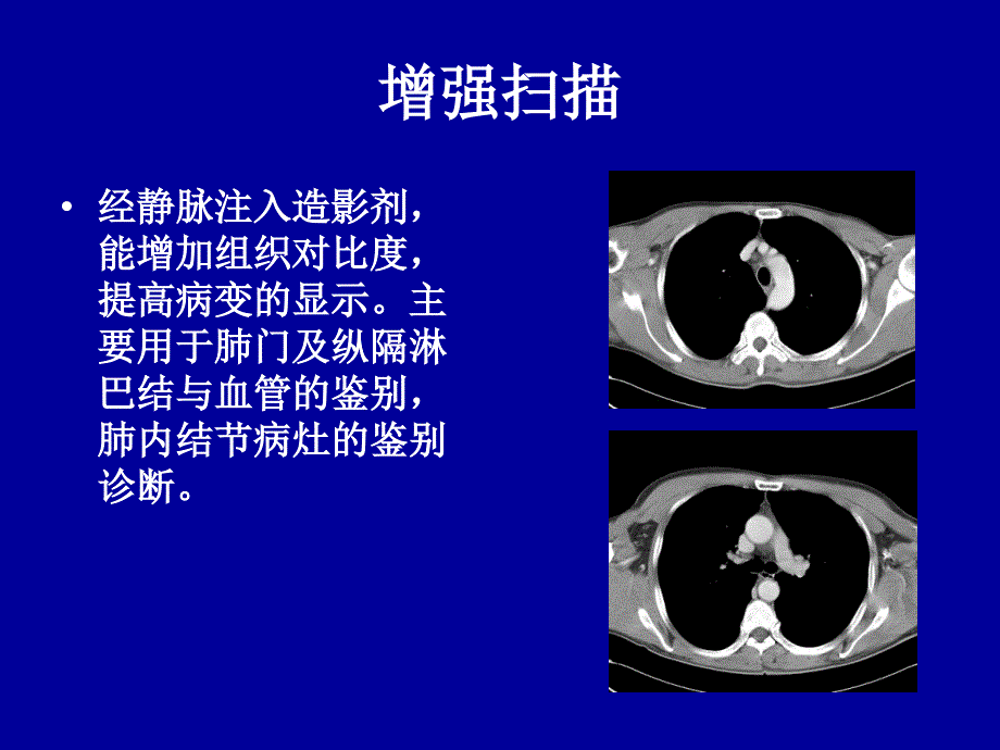 胸部CT基础知识_第4页