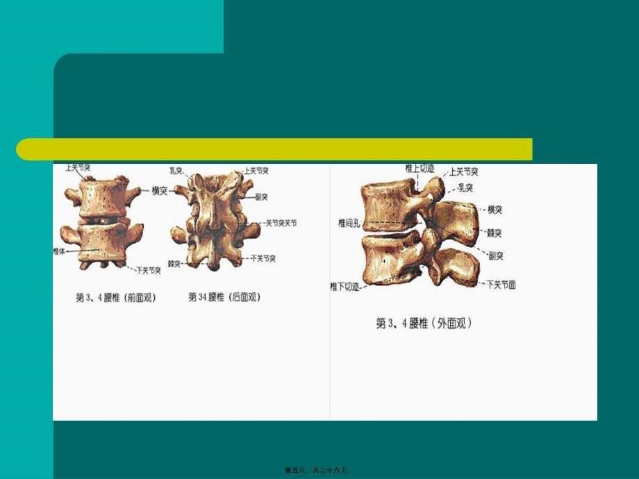 医学专题—腰间盘脱出症诊治幻灯片_第5页