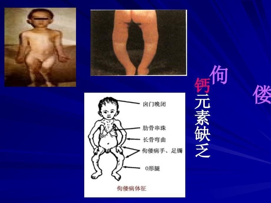 化学元素与人体健康ppt课件_第5页