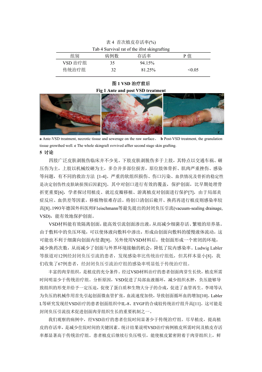 封闭负压吸引治疗四肢创伤性大面积皮肤缺损.doc_第4页