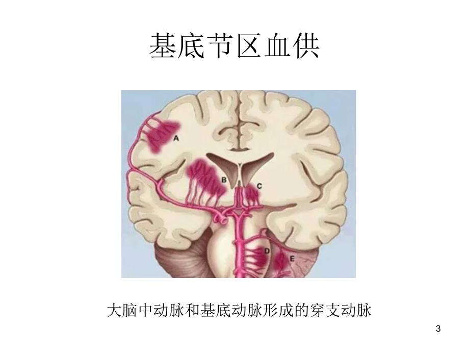 双侧基底节区对称性病变PPT课件_第3页