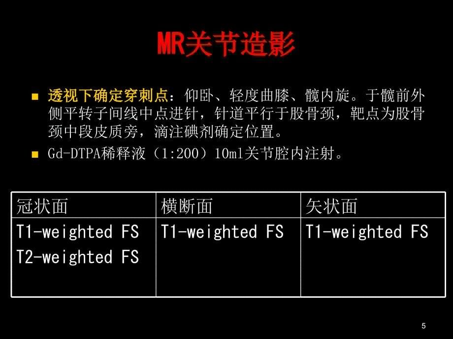 髋关节MagneticResonanceImagingoftheHip课件_第5页