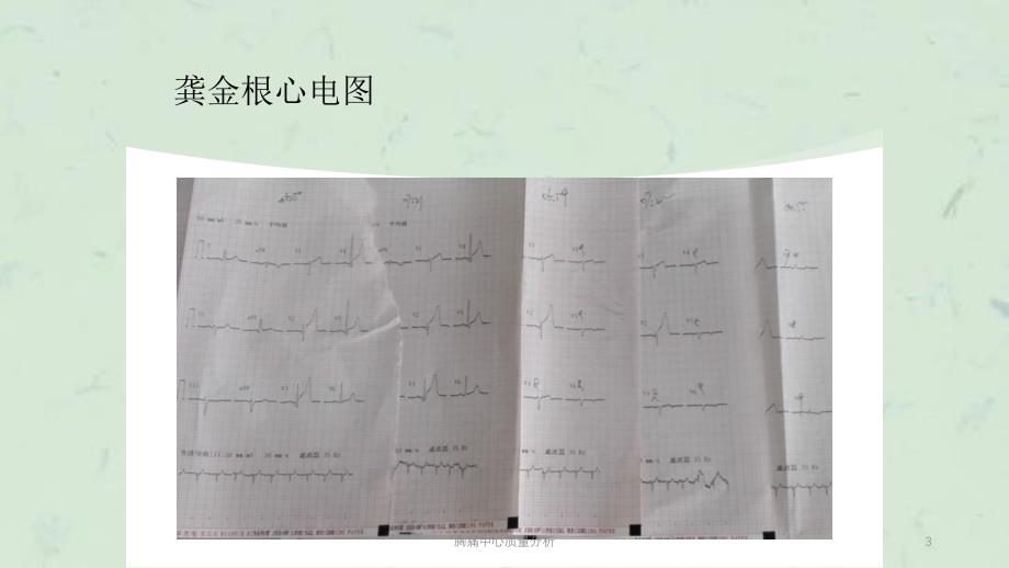 胸痛中心质量分析课件_第3页