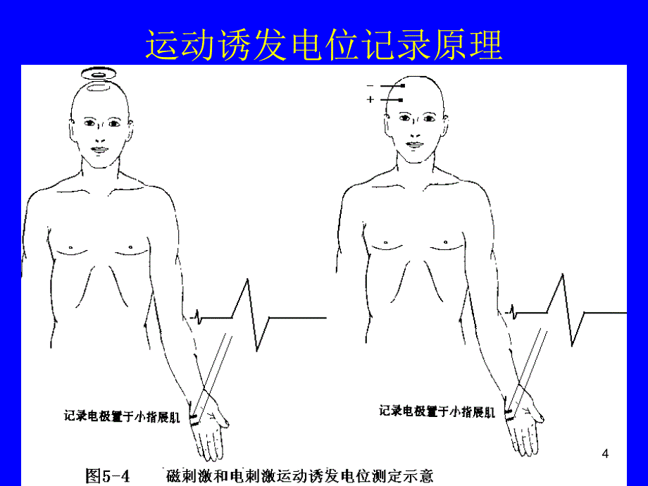 精神障碍事件相关电位检查_第4页