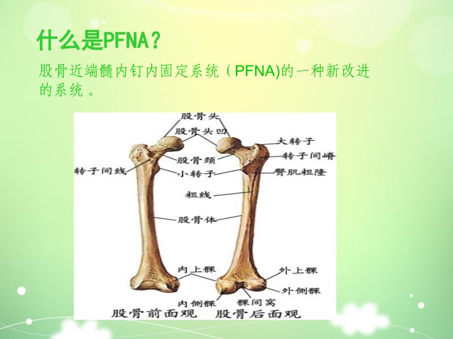 PFNA髓内钉手术配合_第2页