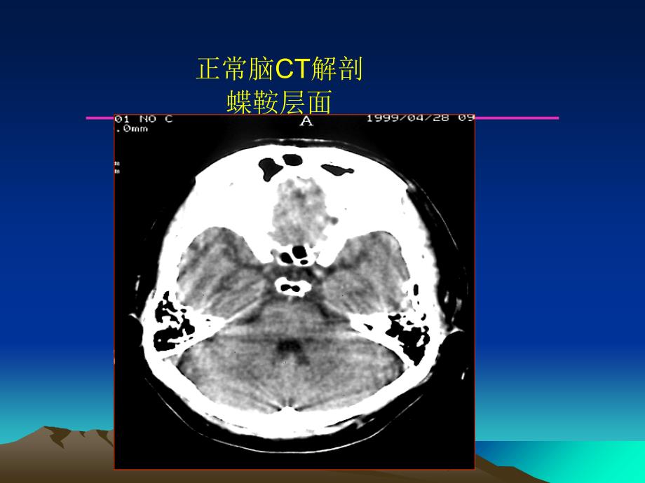 精品中枢神经系统影像诊断学课件精品ppt课件_第2页