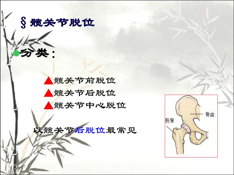 下肢骨与关节损伤PPT课件_第4页