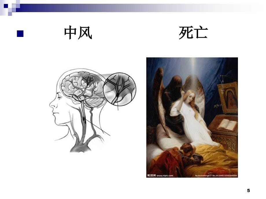 跌倒的有效管理PPT医学课件_第5页