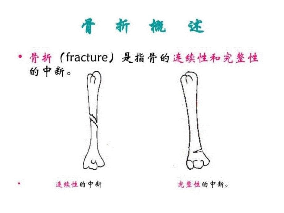 骨与关节疾病病人的护理_第5页