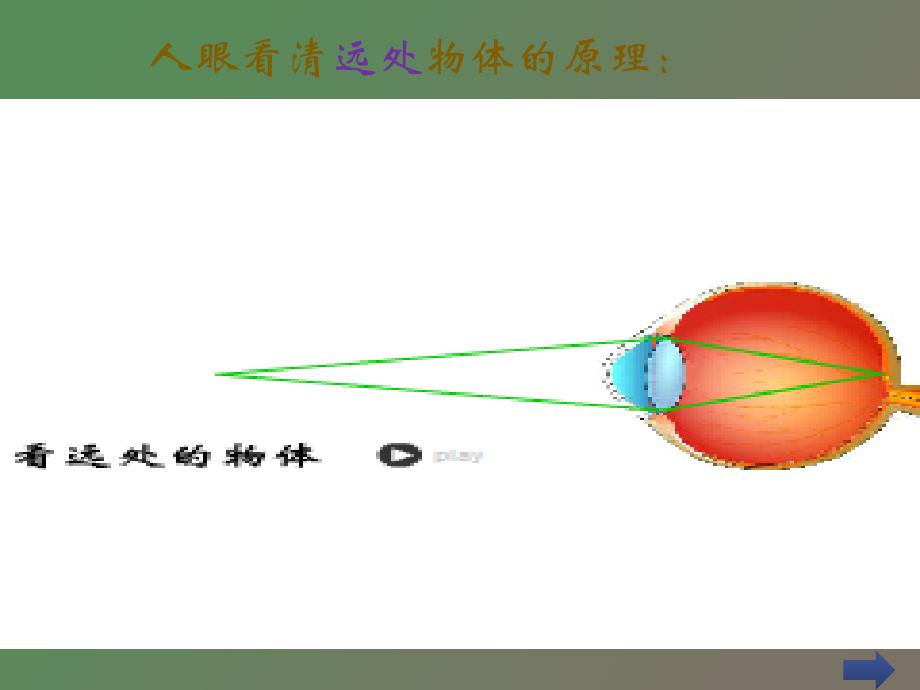 近视眼的防治_第4页