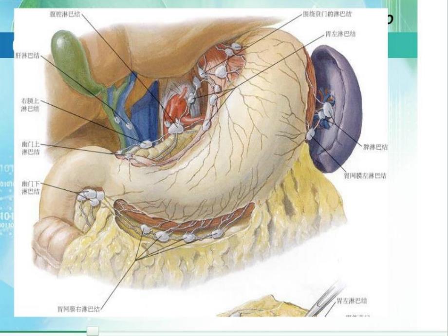 胃癌淋巴结及CT表现课件_第3页