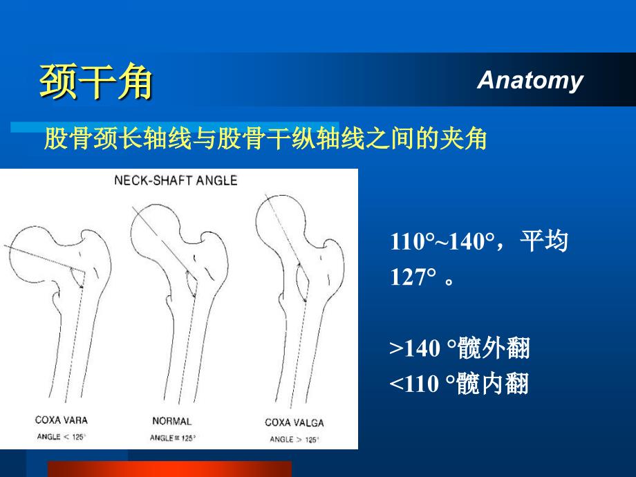 《股骨颈骨折》PPT课件_第3页