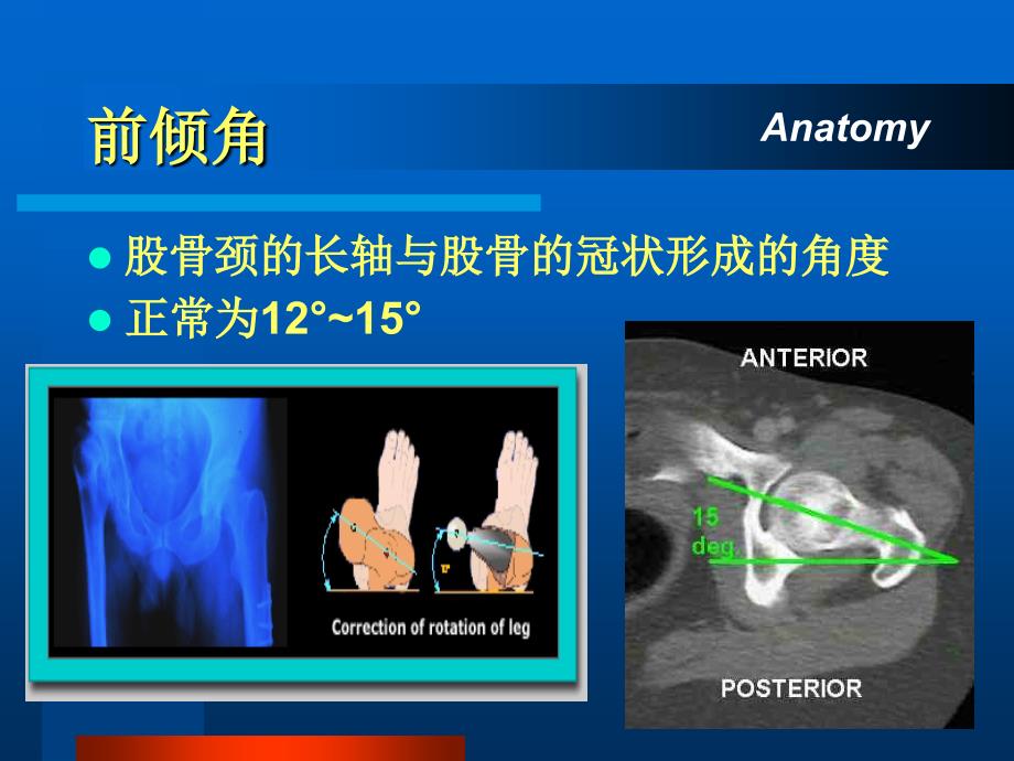 《股骨颈骨折》PPT课件_第4页