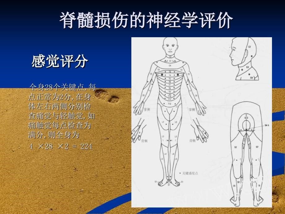 脊柱脊髓损伤的临床康复课件_第5页