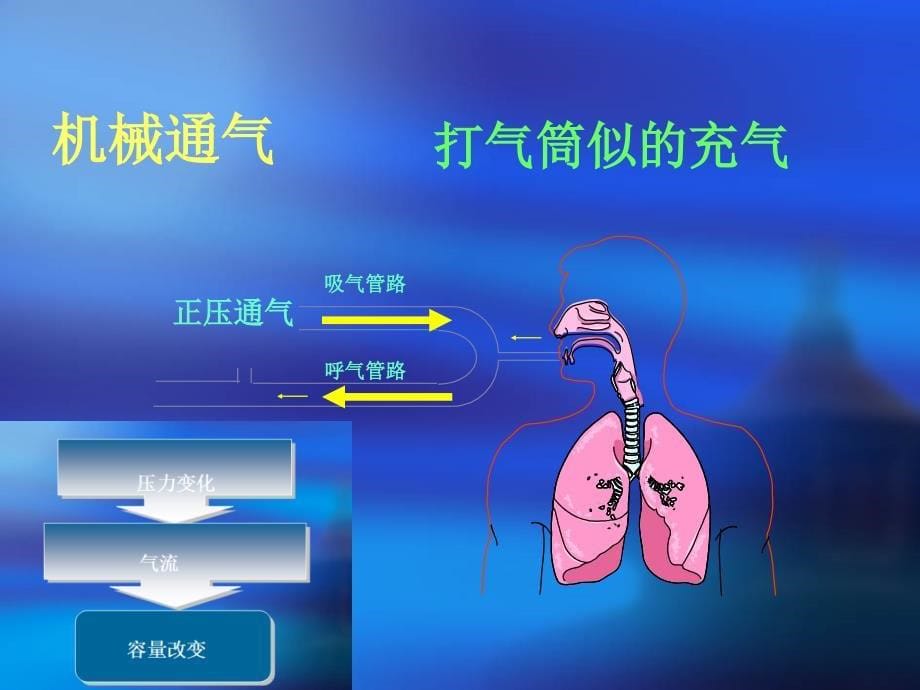 呼吸力学导向的通气设置_第5页