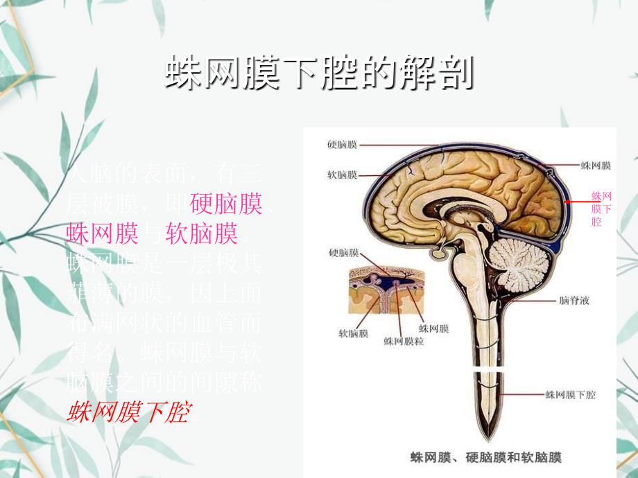 蛛网膜下腔出血修改版_第2页