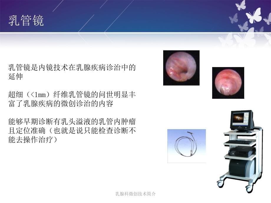 乳腺科微创技术简介课件_第5页