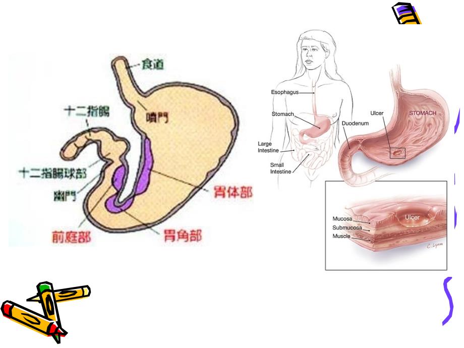 消化性溃疡病人护理医学PPT课件_第4页