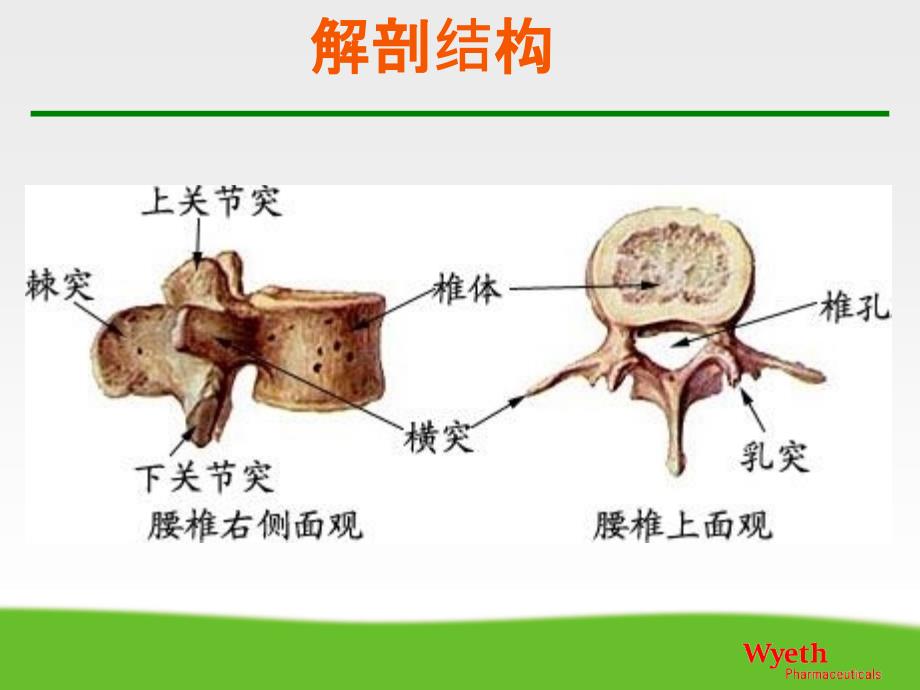 腰椎骨折护理查房83409_第4页