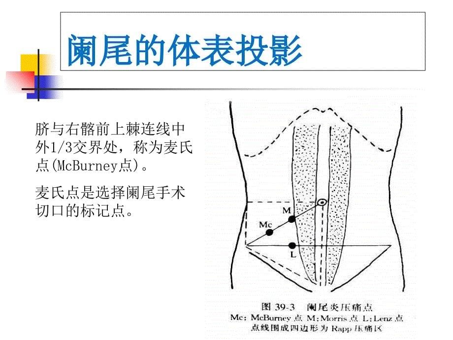 《急性阑尾炎精品》PPT课件_第5页