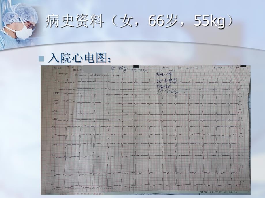 主动脉瓣狭窄病例讨论PPT优秀课件_第4页