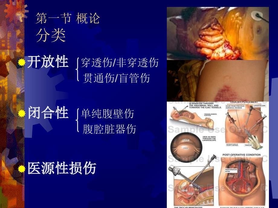 腹部损伤ppt课件_第5页