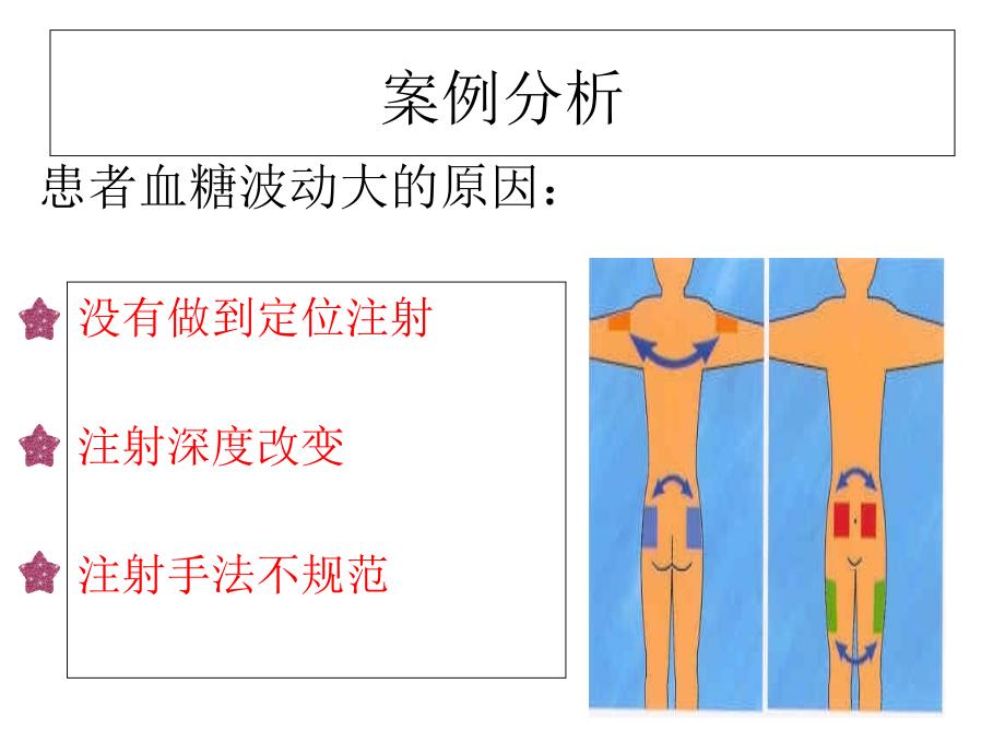 胰岛素注射范记新ppt课件_第4页