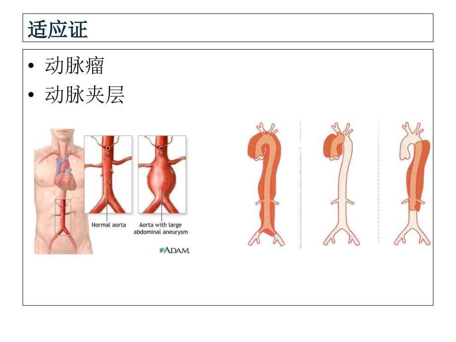 腹部及四肢CTA技术_第5页