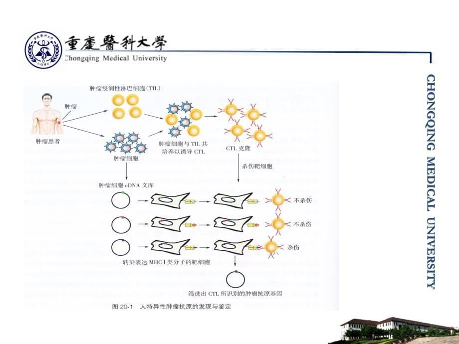 医学免疫学：第20章 肿瘤免疫_第5页