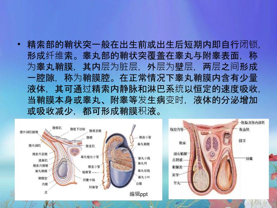 鞘膜积液业务学习_第3页