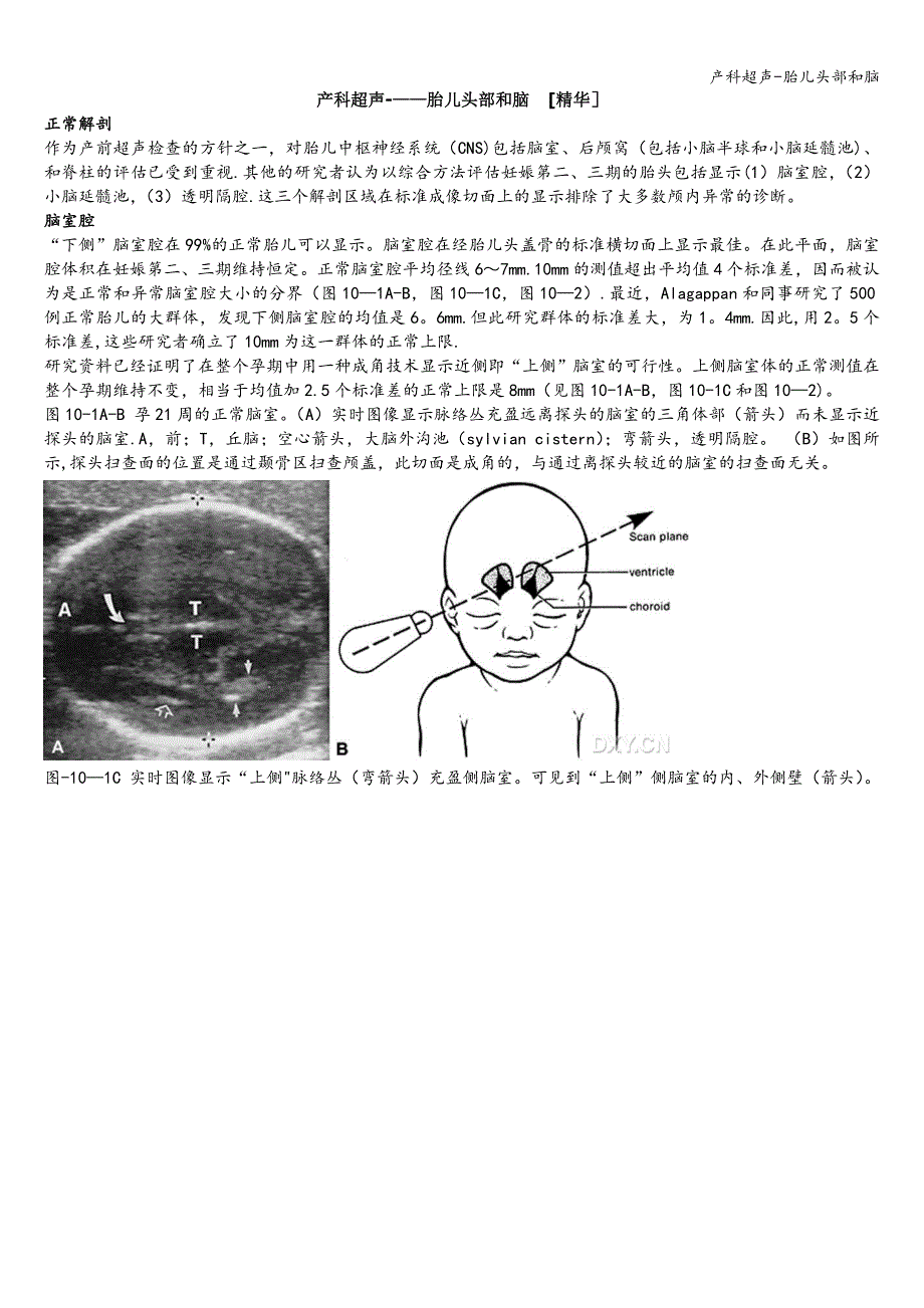 产科超声-胎儿头部和脑.doc_第1页