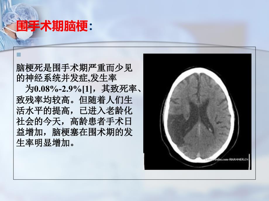 围手术期脑梗_第2页