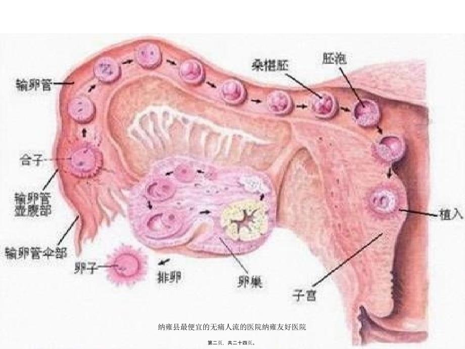 纳雍县最便宜的无痛人流的医院纳雍友好医院课件_第2页