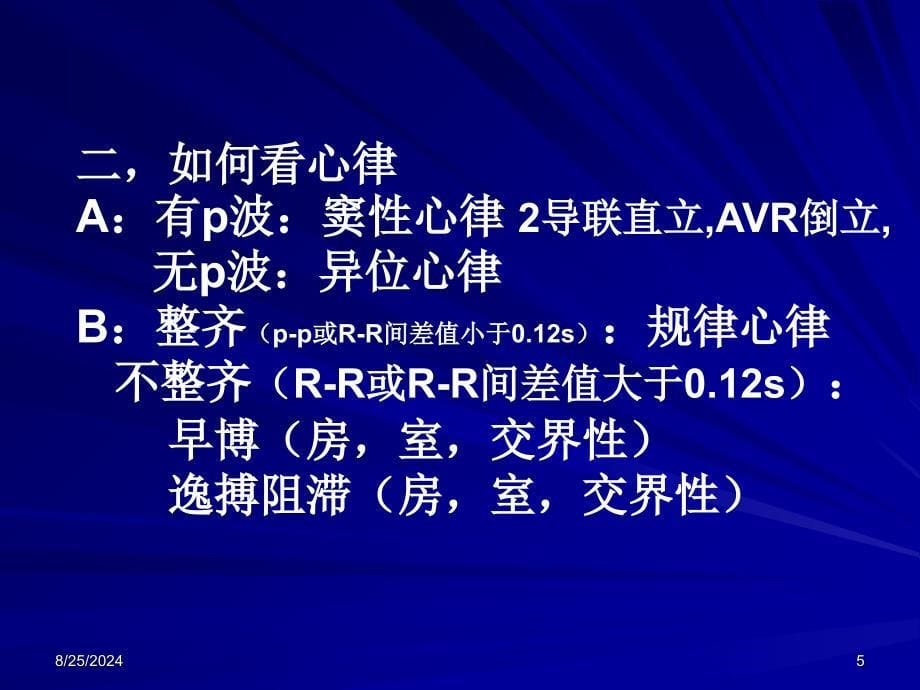 08年医师资格培训心电图内容PPT文档_第5页