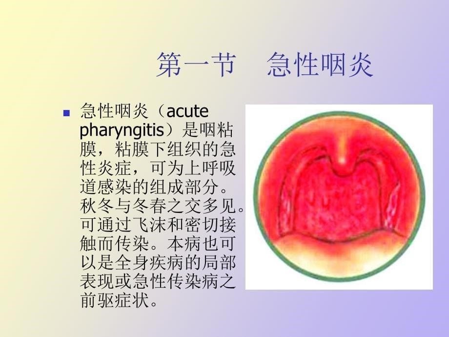 耳鼻喉科常见疾病_第5页