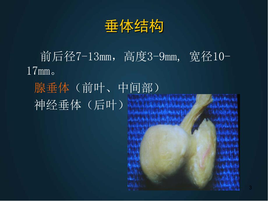 优质课件垂体危象的预防临床表现及治疗_第3页